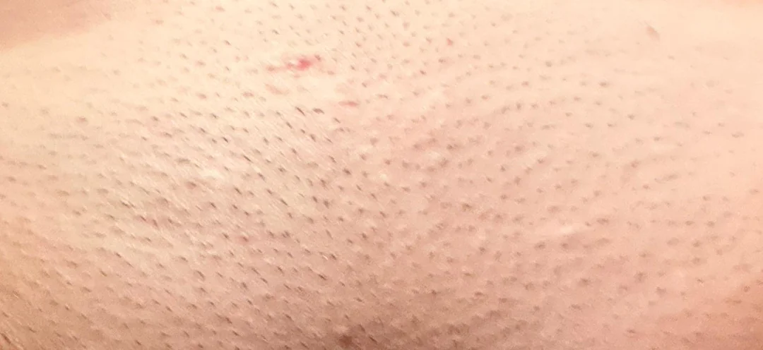 How to Get the Smoothest Shave Down There Expert Tips