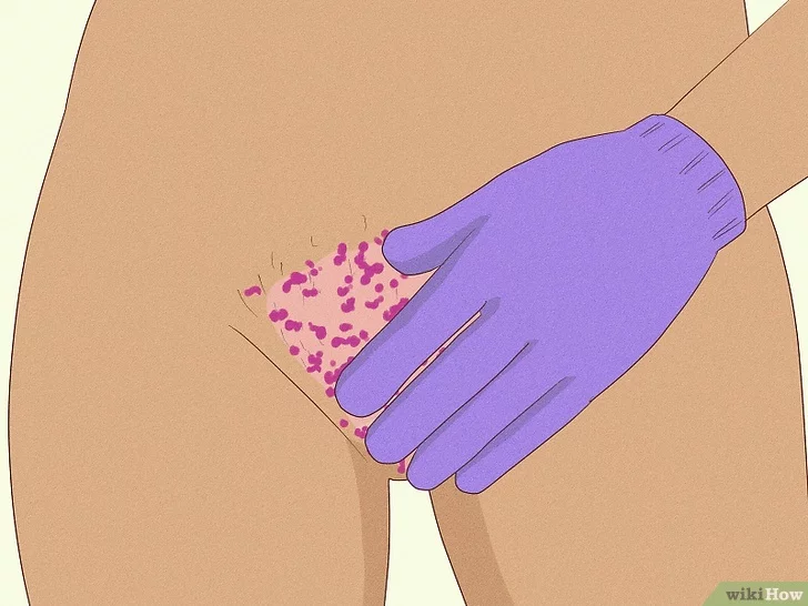 How to Safely Shave Your Vagina Expert Tips for Smooth Skin